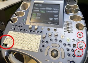 Ось так візульно поломані елементи керування УЗД апарату Voluson E6