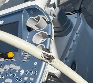Ушкожений дріт конвексного датчика C1-5