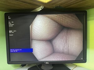 Зображення після ремонту відеопроцесора.